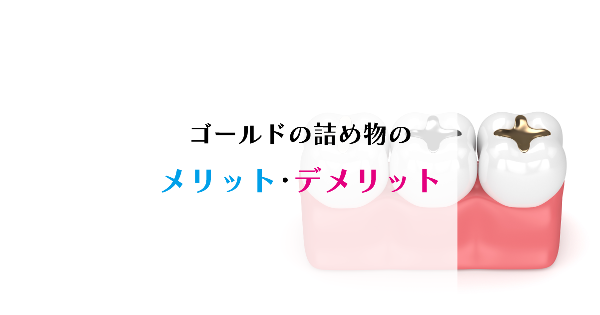 【新潟の歯医者】ゴールドの詰め物のメリット・デメリット