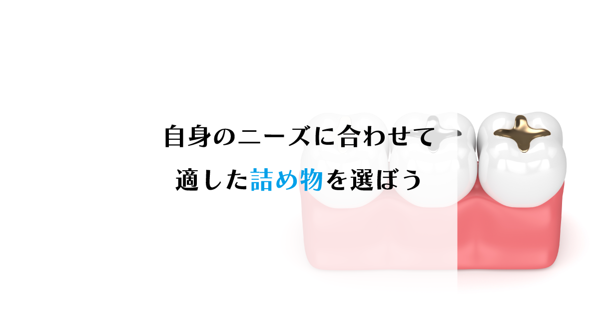 【新潟の歯医者】自身のニーズに合わせて適した詰め物を選ぼう