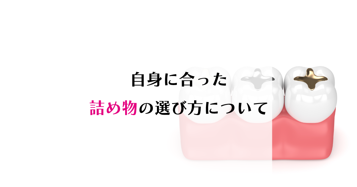 【新潟の歯医者】自身に合った詰め物の選び方について
