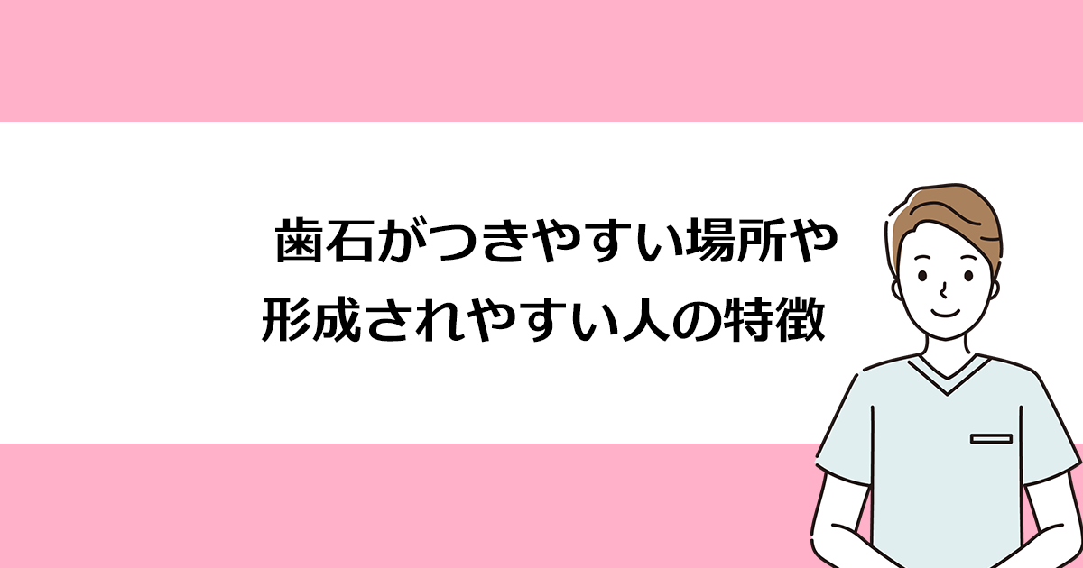 【新潟の歯医者で歯周病治療】歯石がつきやすい場所や形成されやすい人の特徴