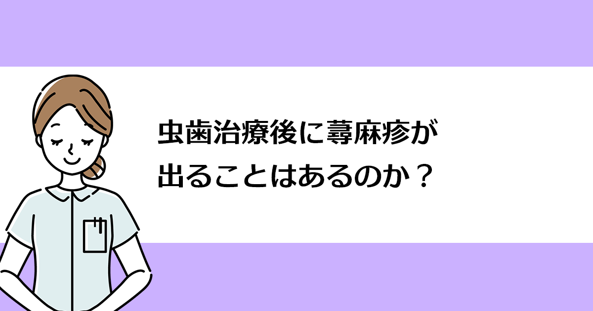 【新潟の歯医者で虫歯治療】虫歯治療後に蕁麻疹が出ることはあるのか?