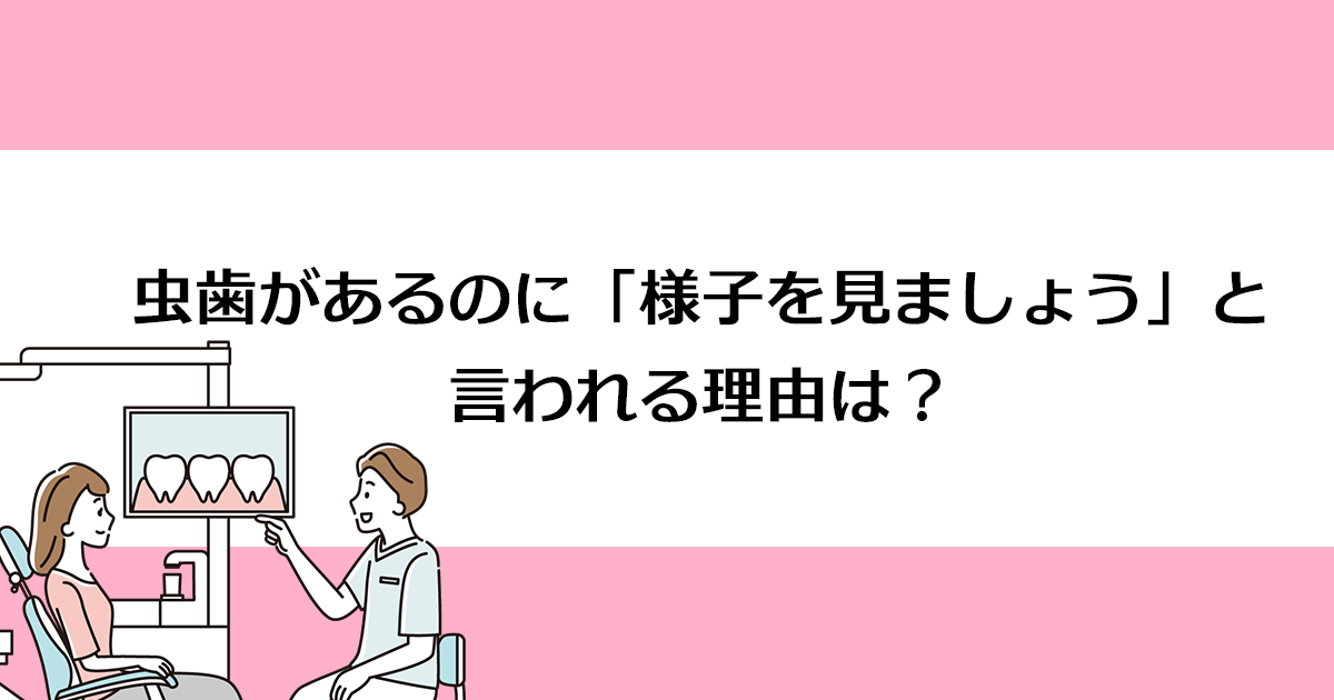 【新潟の歯医者で虫歯治療】虫歯があるのに「様子を見ましょう」と言われる理由は?