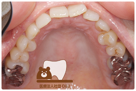 症例3 治療前の写真