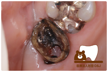 症例3 治療前の写真