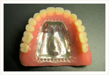 金属床(チタン)義歯