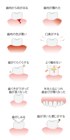 こんな症状がでていたら、歯周病の可能性があります